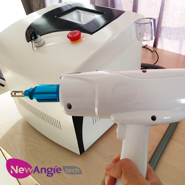 professional shoulder tattoos removal machines